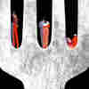 When It Comes To Race, Eating Disorders Don't Discriminate