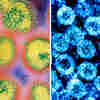 How The Novel Coronavirus And The Flu Are Alike ... And Different