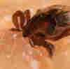 WATCH: How A Tick Digs Its Hooks Into You